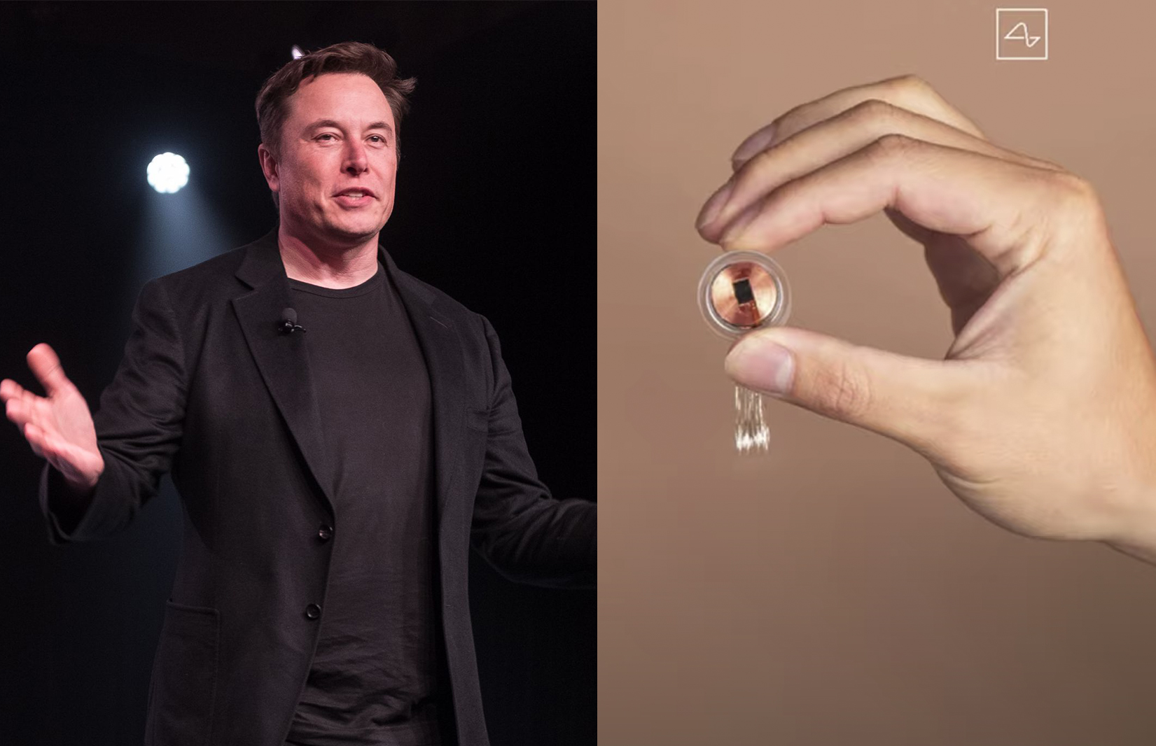 Hazte a un lado Black Mirror, el chip cerebral de Elon Musk es casi una realidad 